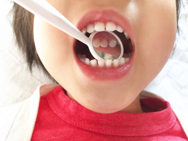 子どもの歯列のイメージ